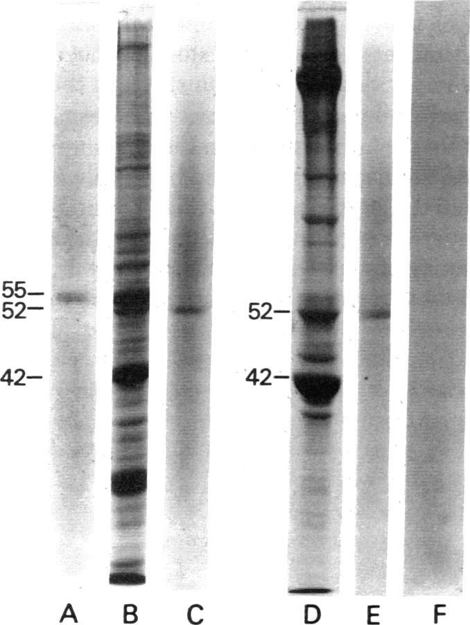 https://cdn.ncbi.nlm.nih.gov/pmc/blobs/5471/319491/28a0da0e5191/pnas00656-0395-a.jpg