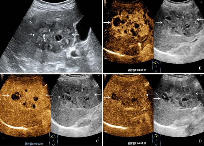 https://cdn.ncbi.nlm.nih.gov/pmc/blobs/547b/10364596/3874af513db2/fonc-13-1106281-g002.jpg