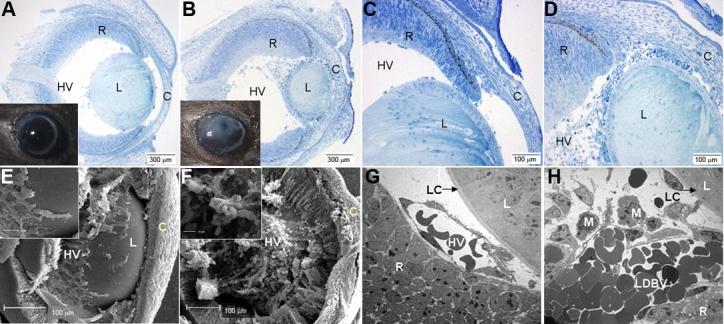 https://cdn.ncbi.nlm.nih.gov/pmc/blobs/547d/2503360/b723bd38a0c0/mv-v13-47-f1.jpg