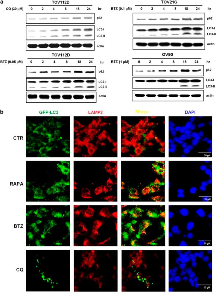 https://cdn.ncbi.nlm.nih.gov/pmc/blobs/547e/4260726/742cf7acb0bc/cddis2014468f3.jpg