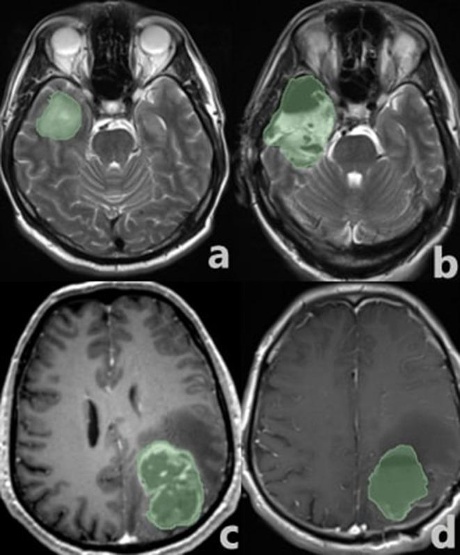 https://cdn.ncbi.nlm.nih.gov/pmc/blobs/5484/11799004/ab996296f006/10143_2025_3301_Fig3_HTML.jpg