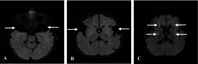 https://cdn.ncbi.nlm.nih.gov/pmc/blobs/5489/11344010/309c1c6e6808/gr2.jpg