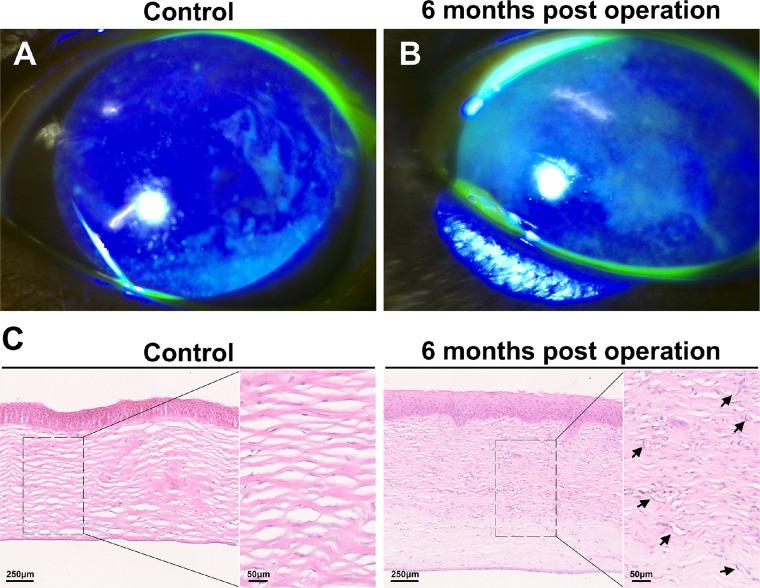 https://cdn.ncbi.nlm.nih.gov/pmc/blobs/5494/9819666/5ebec5ed26d2/tvst-12-1-2-f003.jpg