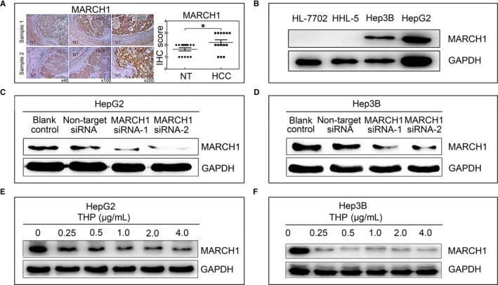 https://cdn.ncbi.nlm.nih.gov/pmc/blobs/5495/6484336/1a7d1e707138/JCMM-23-3386-g001.jpg