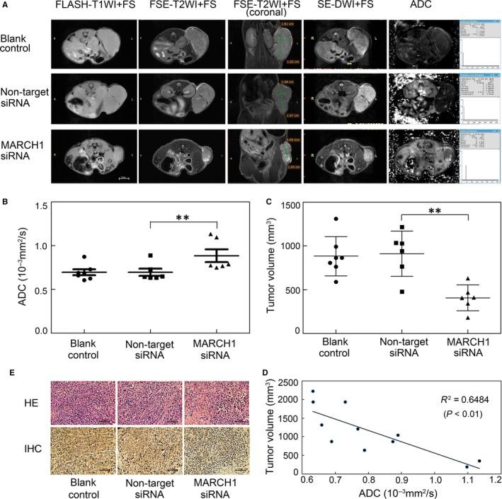https://cdn.ncbi.nlm.nih.gov/pmc/blobs/5495/6484336/b22ab5731f40/JCMM-23-3386-g007.jpg