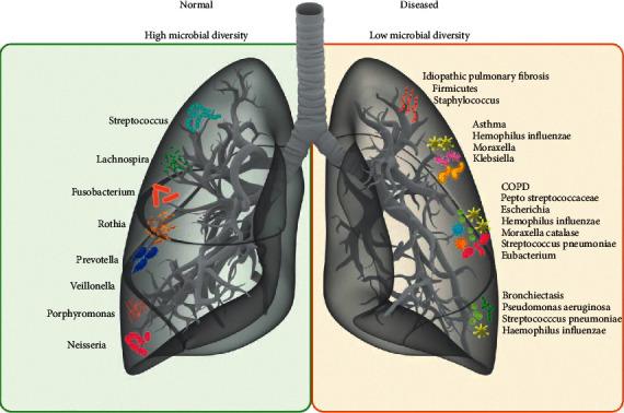 https://cdn.ncbi.nlm.nih.gov/pmc/blobs/5497/8664551/b89d2b782582/CJIDMM2021-9278441.001.jpg