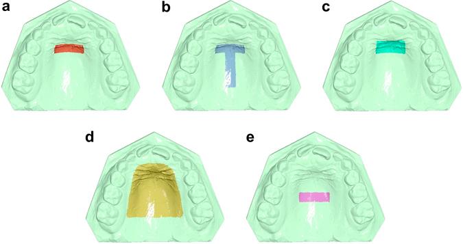 https://cdn.ncbi.nlm.nih.gov/pmc/blobs/54a1/5517608/9f43c128fce3/41598_2017_6013_Fig1_HTML.jpg
