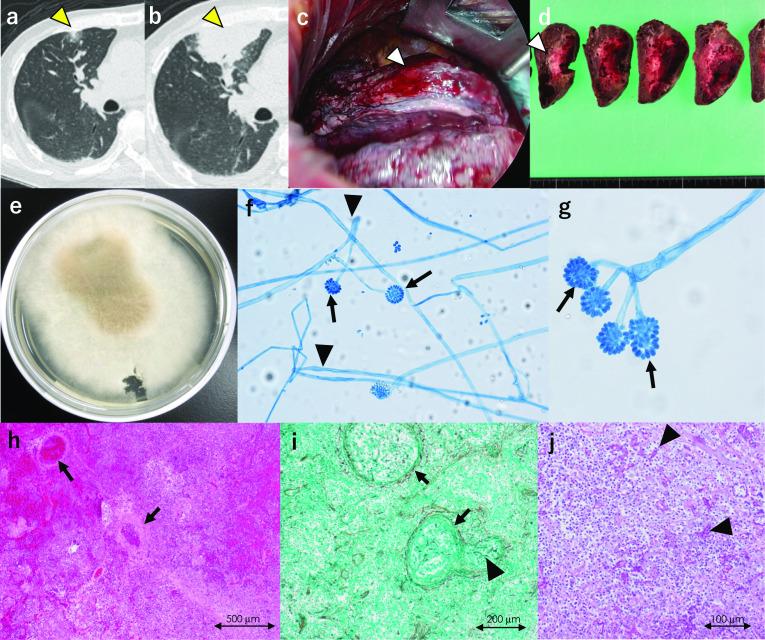 https://cdn.ncbi.nlm.nih.gov/pmc/blobs/54ad/9440188/8d70c04ad050/40792_2022_1516_Fig2_HTML.jpg