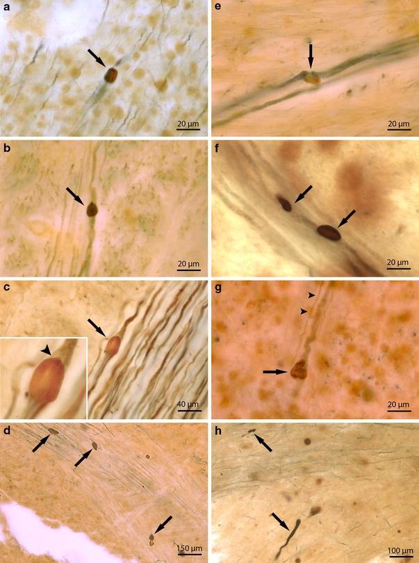 https://cdn.ncbi.nlm.nih.gov/pmc/blobs/54b5/2923324/559160a69444/401_2010_717_Fig1_HTML.jpg