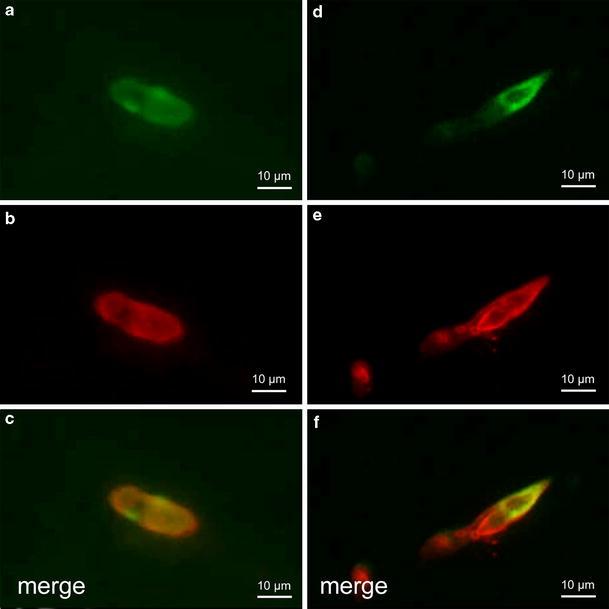 https://cdn.ncbi.nlm.nih.gov/pmc/blobs/54b5/2923324/75516cb7ef97/401_2010_717_Fig6_HTML.jpg