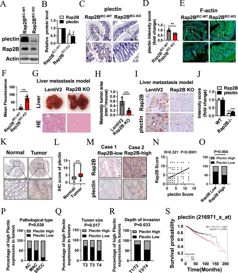 https://cdn.ncbi.nlm.nih.gov/pmc/blobs/54b6/11994759/3d20d05e10e0/41419_2025_7627_Fig8_HTML.jpg