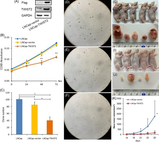 https://cdn.ncbi.nlm.nih.gov/pmc/blobs/54b8/6771699/91f64b7e0758/PROS-79-1647-g004.jpg