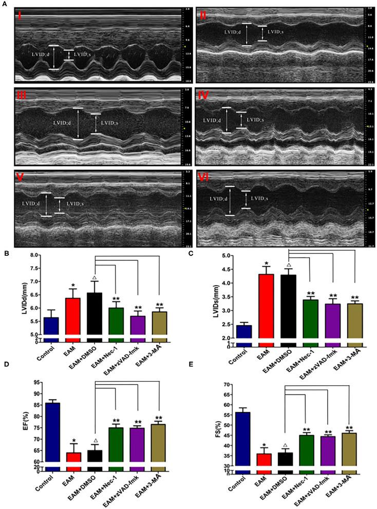https://cdn.ncbi.nlm.nih.gov/pmc/blobs/54b8/8419468/9b61d04fbc8c/fcvm-08-696362-g0004.jpg