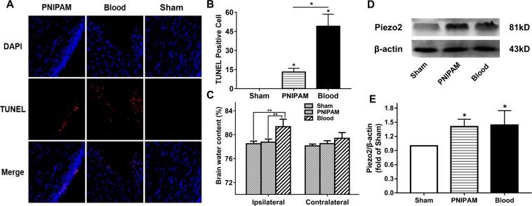 https://cdn.ncbi.nlm.nih.gov/pmc/blobs/54b9/6761290/2747818930d5/41598_2019_50188_Fig4_HTML.jpg