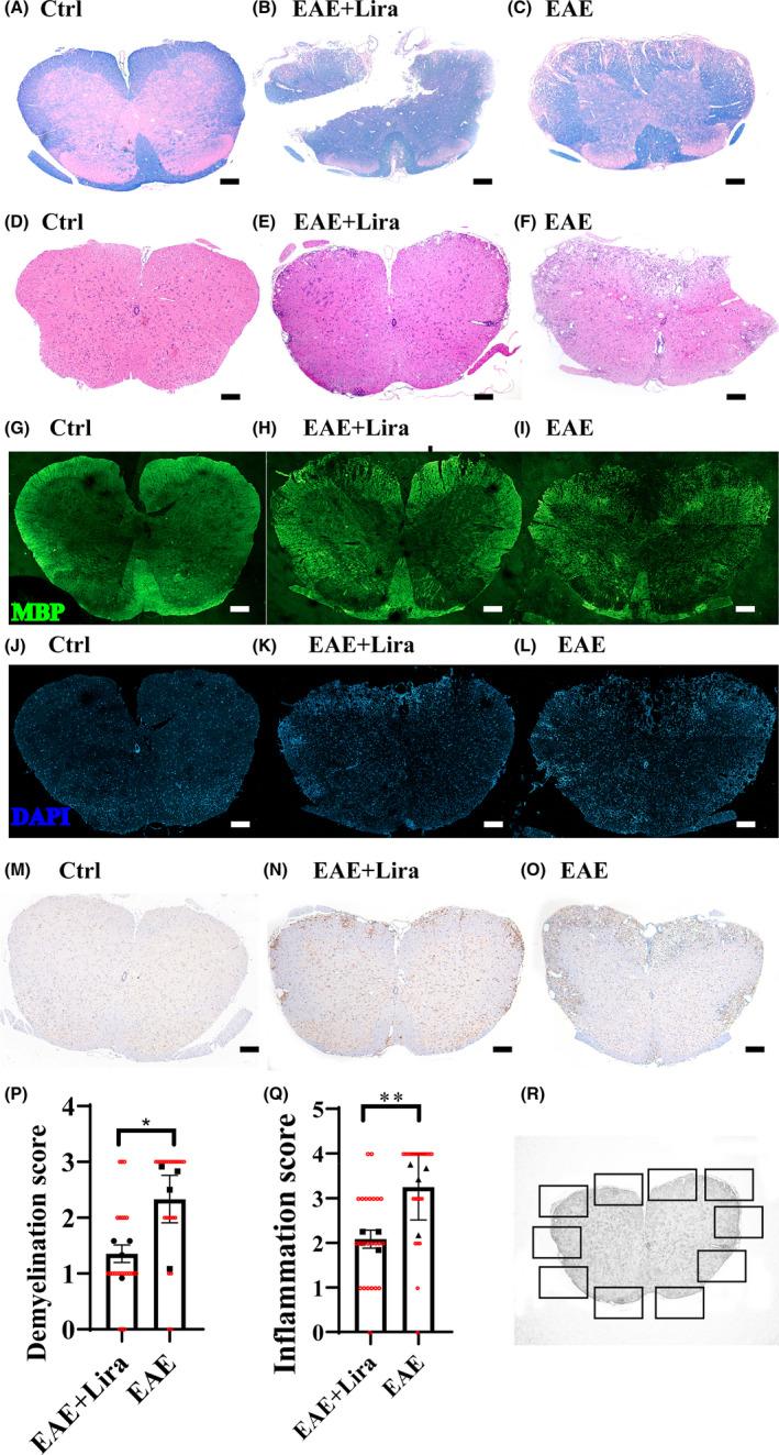 https://cdn.ncbi.nlm.nih.gov/pmc/blobs/54c7/8841291/540d0d88a491/CNS-28-422-g005.jpg