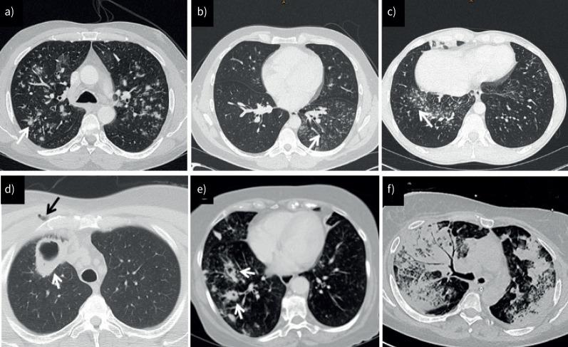 https://cdn.ncbi.nlm.nih.gov/pmc/blobs/54d0/11003523/2ed98612a4b4/EDU-0186-2023.03.jpg