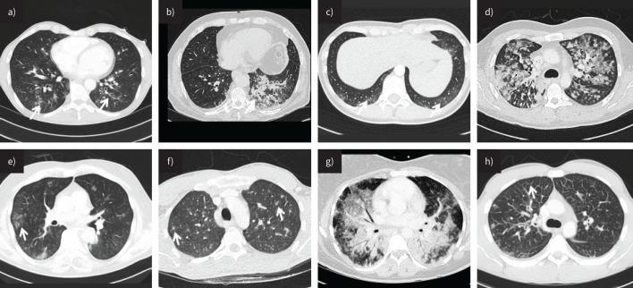 https://cdn.ncbi.nlm.nih.gov/pmc/blobs/54d0/11003523/44f9ee7bb8c8/EDU-0186-2023.04.jpg