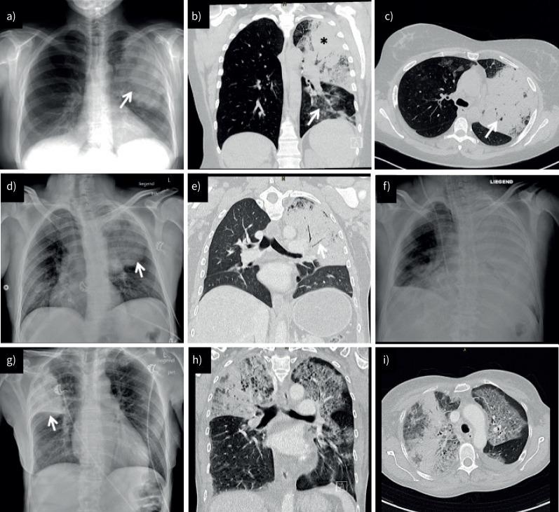 https://cdn.ncbi.nlm.nih.gov/pmc/blobs/54d0/11003523/81955ca74f39/EDU-0186-2023.02.jpg