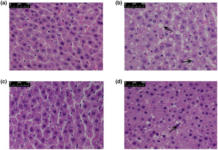 https://cdn.ncbi.nlm.nih.gov/pmc/blobs/54d6/11016437/e19d22b5d38e/FSN3-12-2833-g003.jpg