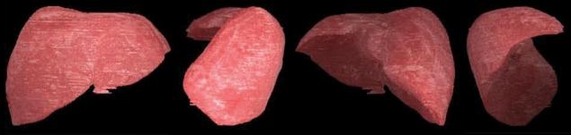 https://cdn.ncbi.nlm.nih.gov/pmc/blobs/54d8/2698180/819dc3a23560/jkms-24-375-g008.jpg