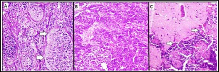 https://cdn.ncbi.nlm.nih.gov/pmc/blobs/54d8/4928403/9894801aa861/PJMS-32-585-g001.jpg