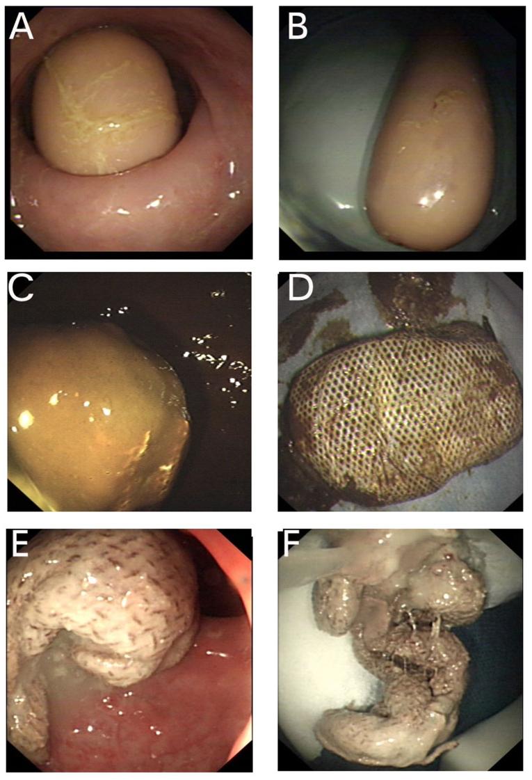 https://cdn.ncbi.nlm.nih.gov/pmc/blobs/54da/5403636/989eb0e566f3/mco-06-03-0355-g01.jpg