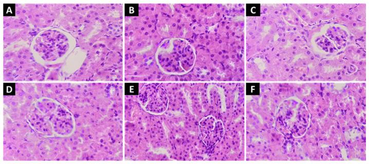 https://cdn.ncbi.nlm.nih.gov/pmc/blobs/54db/10343488/c8ebf5249d9b/molecules-28-05112-g004.jpg