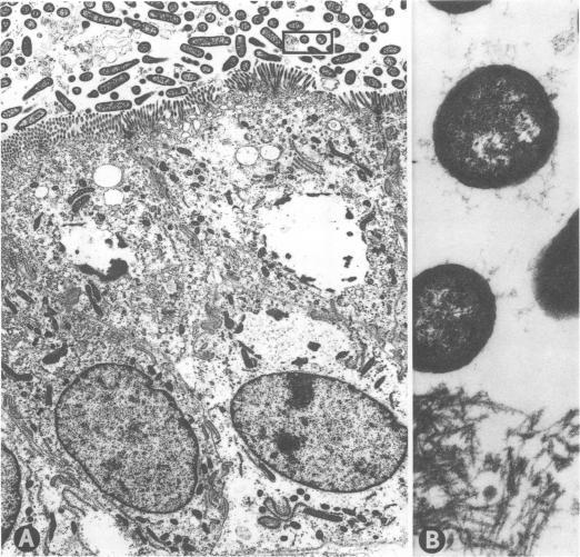 https://cdn.ncbi.nlm.nih.gov/pmc/blobs/54db/351030/277949ed43db/iai00153-0327-a.jpg