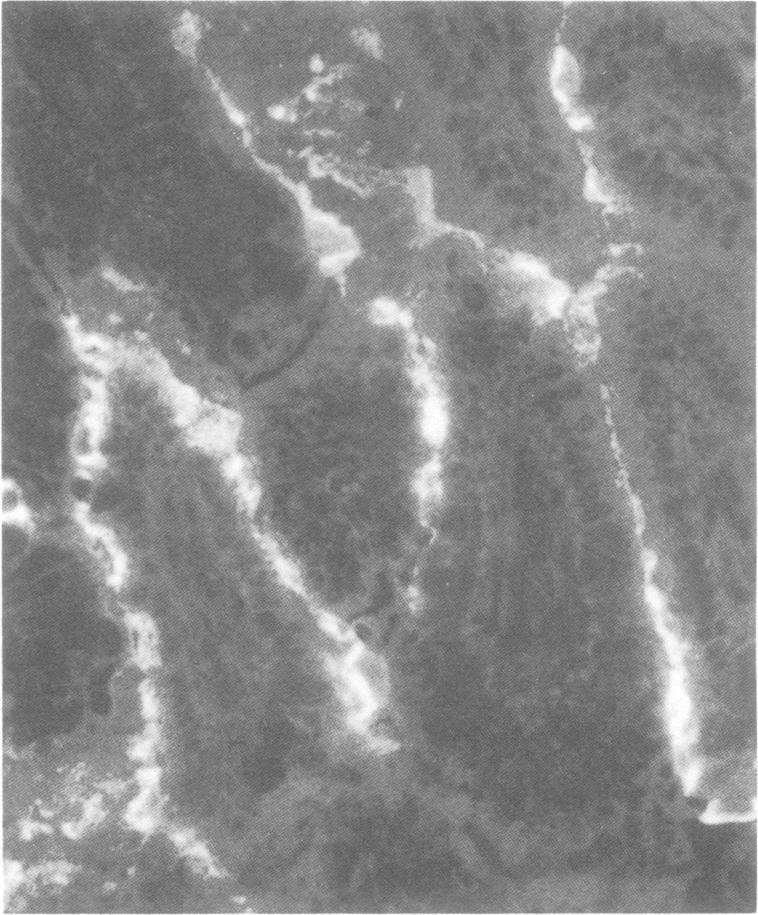 https://cdn.ncbi.nlm.nih.gov/pmc/blobs/54db/351030/b97fe9162caa/iai00153-0326-a.jpg