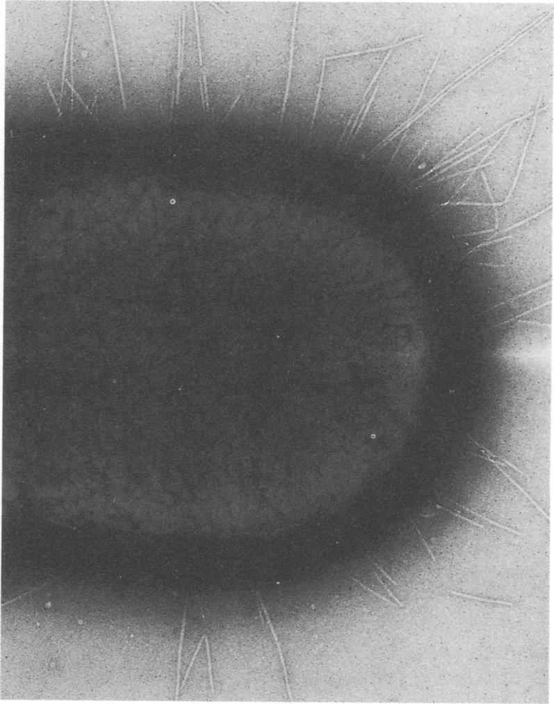 https://cdn.ncbi.nlm.nih.gov/pmc/blobs/54db/351030/d2e141b51bb7/iai00153-0325-a.jpg