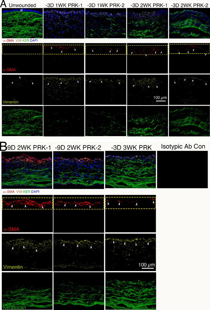 https://cdn.ncbi.nlm.nih.gov/pmc/blobs/54dc/10187792/6b6614ad303e/tvst-12-5-15-f002a.jpg