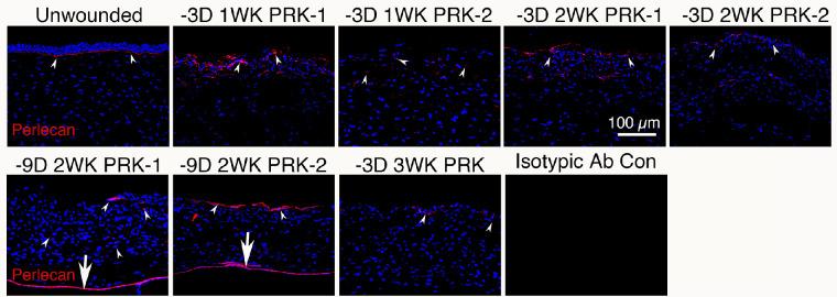 https://cdn.ncbi.nlm.nih.gov/pmc/blobs/54dc/10187792/9af10c1aa436/tvst-12-5-15-f003.jpg