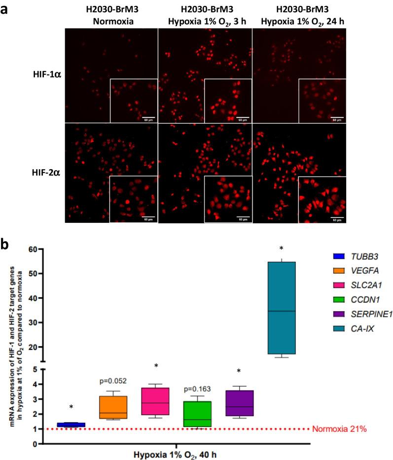 https://cdn.ncbi.nlm.nih.gov/pmc/blobs/54ec/10676347/83a075555ea8/13550_2023_1052_Fig1_HTML.jpg