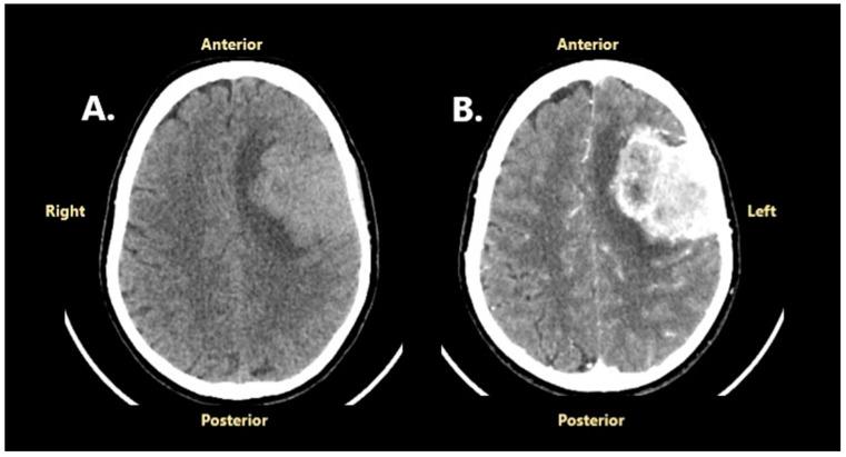 https://cdn.ncbi.nlm.nih.gov/pmc/blobs/54f2/12028147/0bca14210cbf/jcm-14-02731-g001.jpg