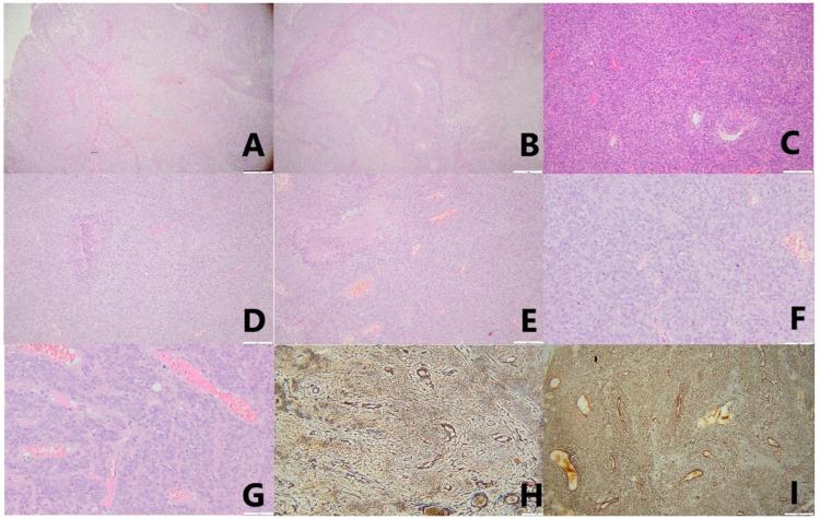 https://cdn.ncbi.nlm.nih.gov/pmc/blobs/54f2/12028147/0eeed550e820/jcm-14-02731-g005.jpg