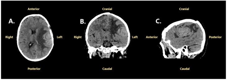 https://cdn.ncbi.nlm.nih.gov/pmc/blobs/54f2/12028147/26157b7ddf95/jcm-14-02731-g008.jpg