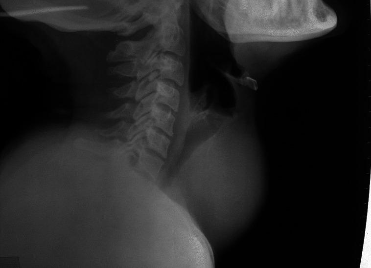 https://cdn.ncbi.nlm.nih.gov/pmc/blobs/54f3/3683195/270bec8760f8/IJEM-17-228-g002.jpg