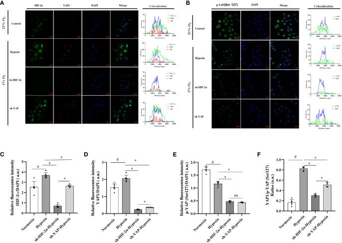 https://cdn.ncbi.nlm.nih.gov/pmc/blobs/54f6/10946064/a82fa4f3de65/fendo-15-1344971-g007.jpg