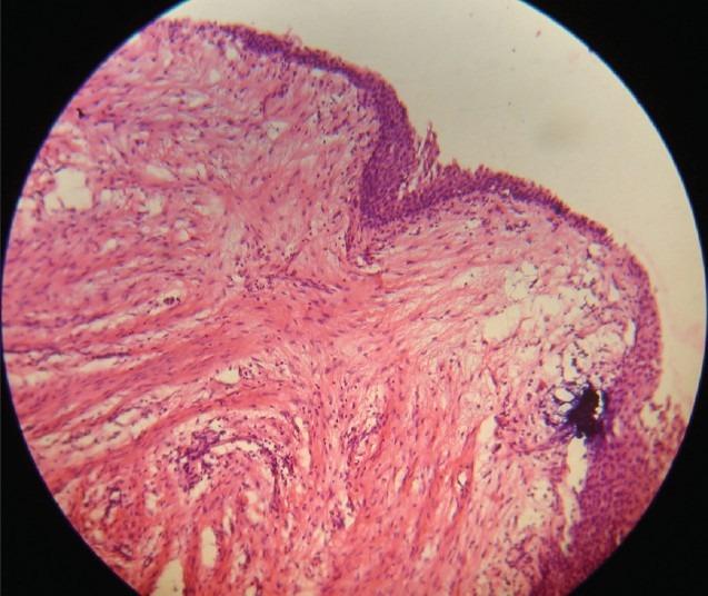 https://cdn.ncbi.nlm.nih.gov/pmc/blobs/54fb/3888999/ae75c04d3bc0/JSTCR-5-21-g008.jpg
