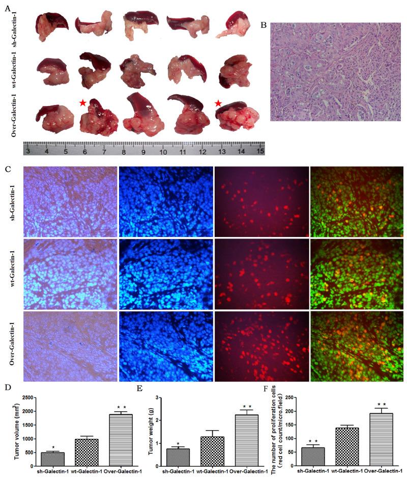 https://cdn.ncbi.nlm.nih.gov/pmc/blobs/54fd/5689700/893dc1319628/oncotarget-08-86488-g004.jpg