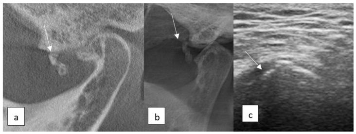 https://cdn.ncbi.nlm.nih.gov/pmc/blobs/54ff/12072138/5557b7fb5b64/diagnostics-15-01160-g005.jpg