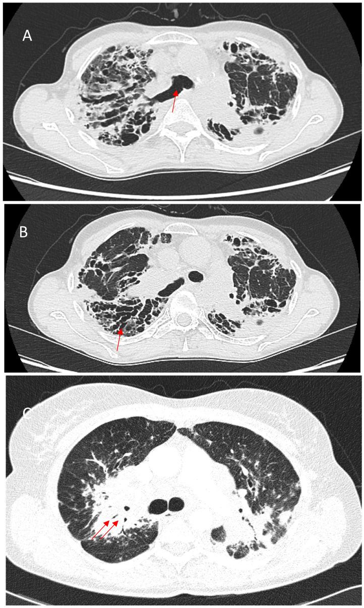 https://cdn.ncbi.nlm.nih.gov/pmc/blobs/5505/11989801/1b1a1eb67d2f/jcm-14-02381-g003.jpg