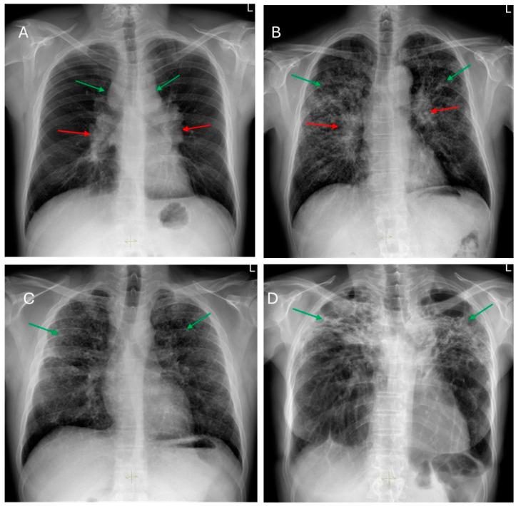 https://cdn.ncbi.nlm.nih.gov/pmc/blobs/5505/11989801/627d95c2749e/jcm-14-02381-g002.jpg