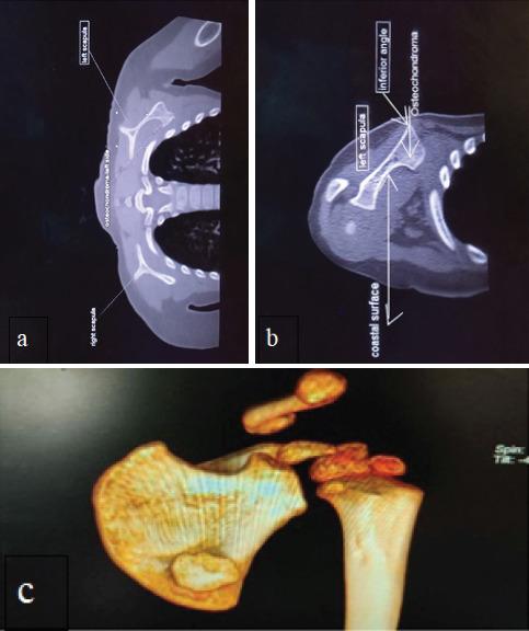 https://cdn.ncbi.nlm.nih.gov/pmc/blobs/5507/8576767/b95220a631b3/JOCR-11-82-g002.jpg