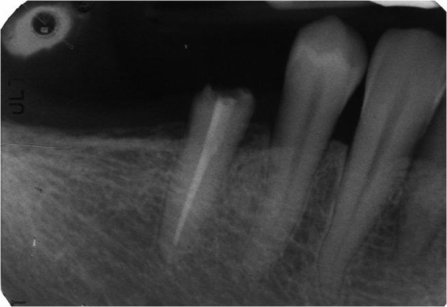 https://cdn.ncbi.nlm.nih.gov/pmc/blobs/550a/7021168/c103b8d67a47/CCIDE-12-17-g0002.jpg