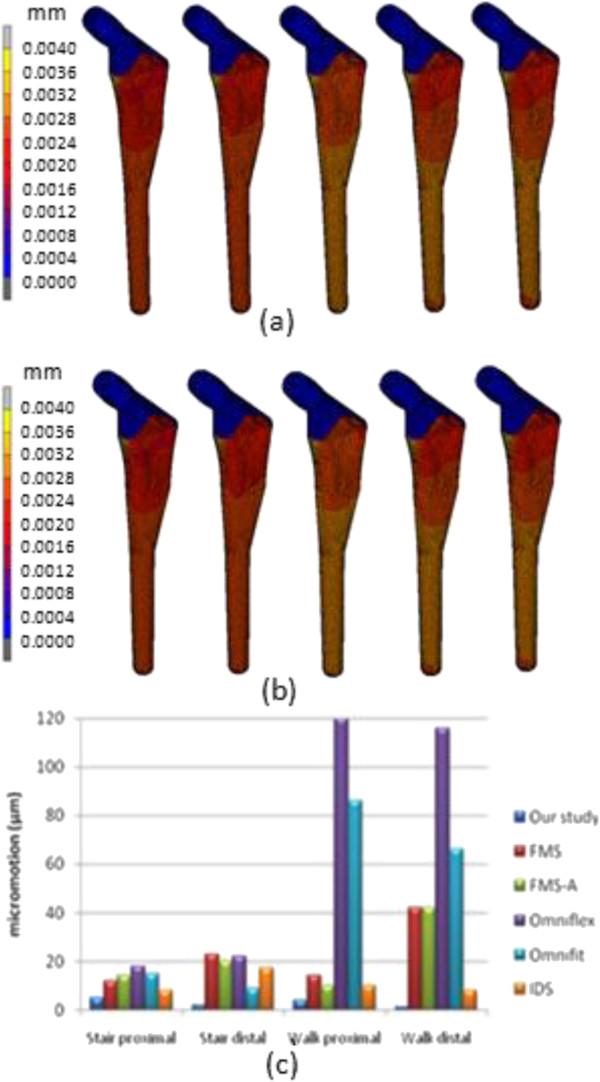 https://cdn.ncbi.nlm.nih.gov/pmc/blobs/5510/3924227/bf2ddca0cd79/1471-2474-15-30-10.jpg