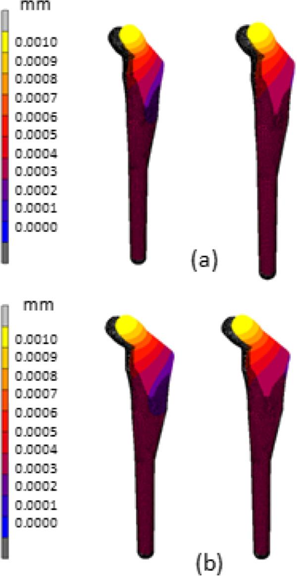https://cdn.ncbi.nlm.nih.gov/pmc/blobs/5510/3924227/e8b6b2b863ca/1471-2474-15-30-11.jpg