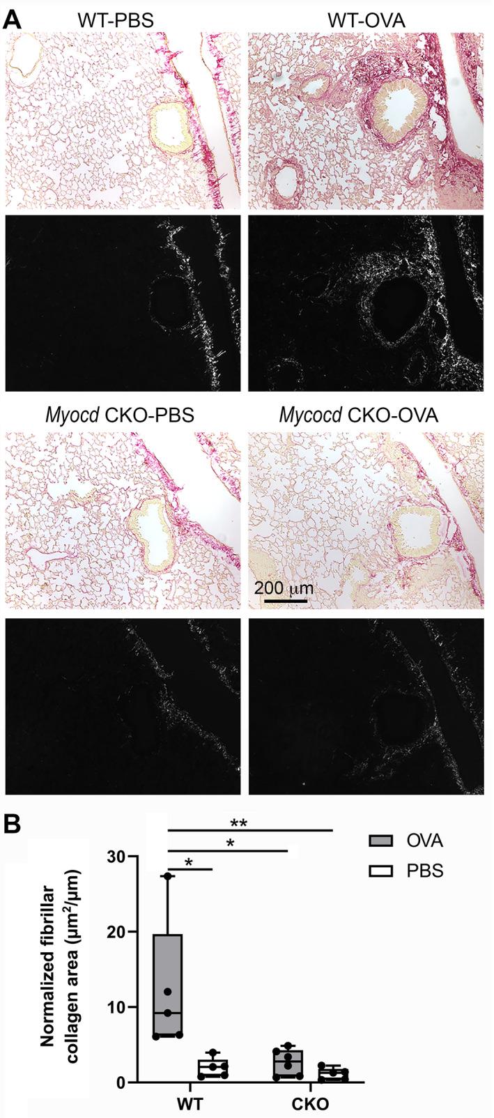 https://cdn.ncbi.nlm.nih.gov/pmc/blobs/5517/10107741/6e018c7fd83f/PATH-259-331-g001.jpg