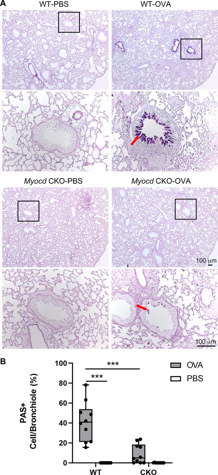 https://cdn.ncbi.nlm.nih.gov/pmc/blobs/5517/10107741/d0a3cf463a77/PATH-259-331-g006.jpg
