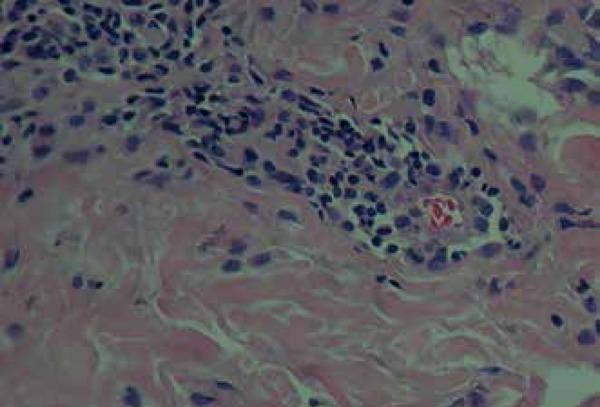 https://cdn.ncbi.nlm.nih.gov/pmc/blobs/5517/5324997/c1fdc02696e4/abd-91-05-s1-0066-g04.jpg